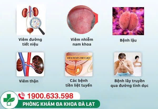 Hình ảnh minh họa